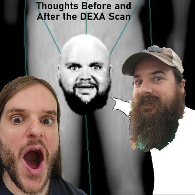 Thoughts Before and After the DEXA Scan...in Montréal