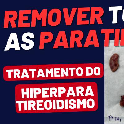 Retirada Total da Tireoide e das 4 Paratireoides: Como Fica a Saúde Depois da Cirurgia? Retirada Total da Tireoide e das 4 Paratireoides: Como Fica a Saúde Depois da Cirurgia?