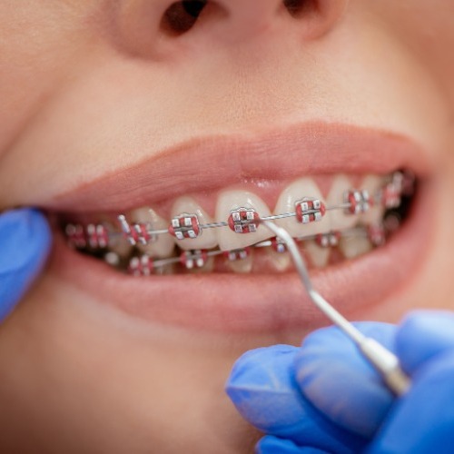 Why You Need an Experienced Orthodontist in Calgary Why You Need an Experienced Orthodontist in Calgary