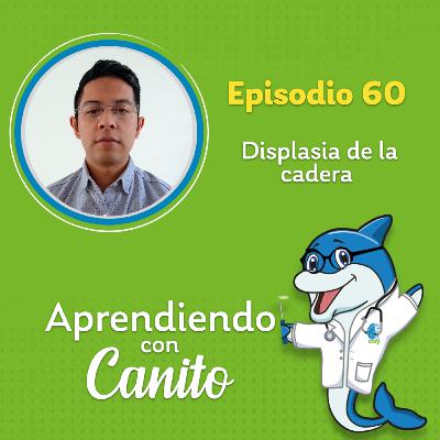 60: Displasia de la cadera