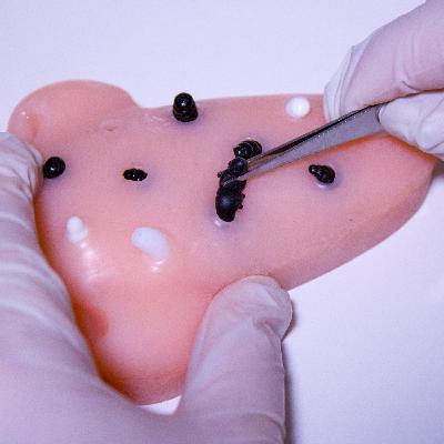 ASMR: Extracción de puntos negros extremadamente satisfactorio con reverberación