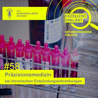 Präzisionsmedizin bei chronischen Entzündungserkrankungen