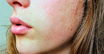 La pelle racconta: piccoli segnali da ascoltare al rientro