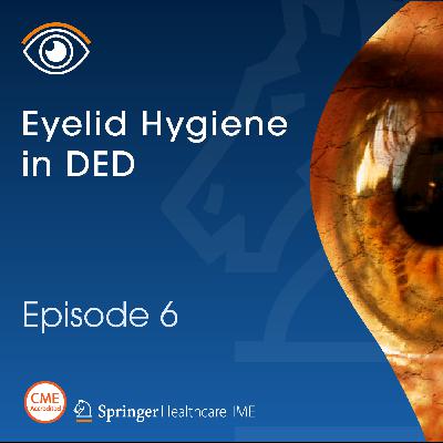 Episode 6: Eyelid Hygiene in DED