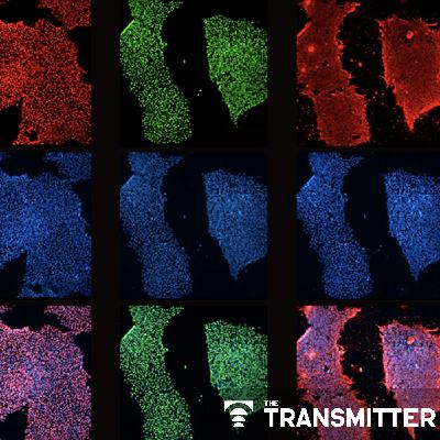 Bringing African ancestry into cellular neuroscience