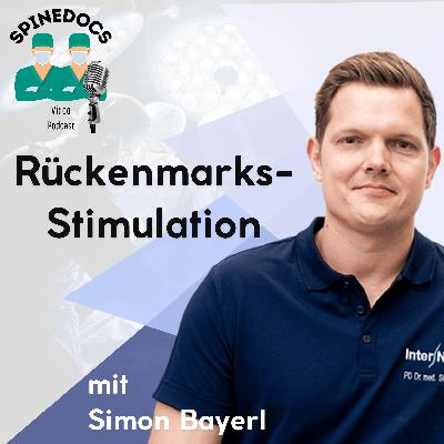 Rückenmarksstimulation