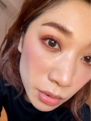 ホワイトニング後の歯 from Radiotalk