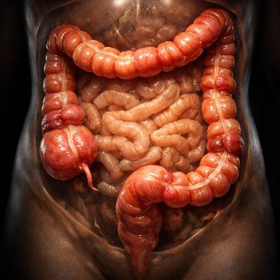 Dolor abdominal crónico: Enfermedad de Crohn