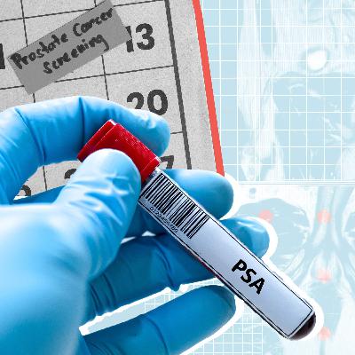 What to know about prostate cancer What to know about prostate cancer