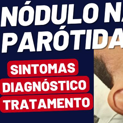 Nódulo na Parótida: Conheça as Opções de Tratamento Nódulo na Parótida: Conheça as Opções de Tratamento