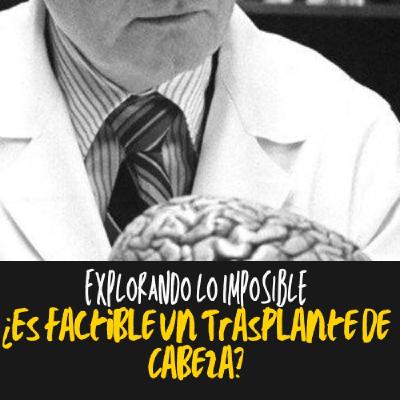"Explorando lo Imposible: ¿Es Factible un Trasplante de Cabeza?"