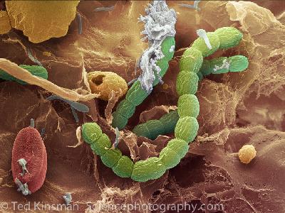 Inside the Lens Episode 2: Images From Electrons Inside the Lens Episode 2: Images From Electrons
