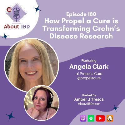 How Propel a Cure is Transforming Crohn's Disease Research
