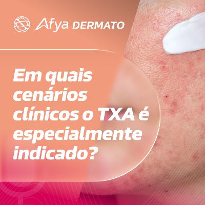 Em quais cenários clínicos o TXA é especialmente indicado?