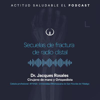 Secuelas de fractura de radio distal | Hospital Galenia - E286 Secuelas de fractura de radio distal | Hospital Galenia - E286