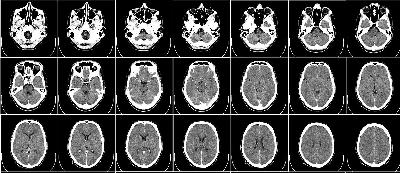 Tıpta kullanılan görüntüleme sistemlerinin fiziği – Burçin Ünlü