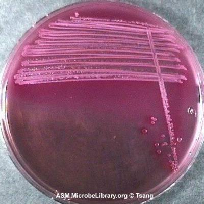 Ch.24. part 1. Digestive System Infections