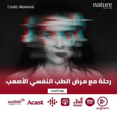 من الجنون إلى الفصام: رحلة مع مرض الطب النفسي الأصعب