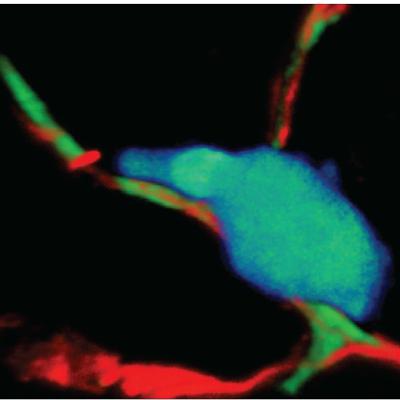 The Adaptive Immune Response in Space and Time( immunology part 14)