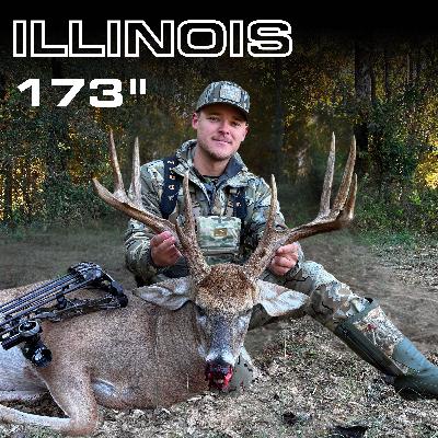 Six Months After Brain Surgery - He Tagged a GIANT (Taylor Thomas) | Big Buck Blueprint