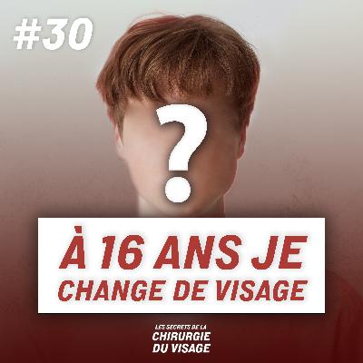 #30 - "À 16 ANS JE CHANGE DE VISAGE" : RÉCIT D’UNE OPÉRATION DE LA MÂCHOIRE