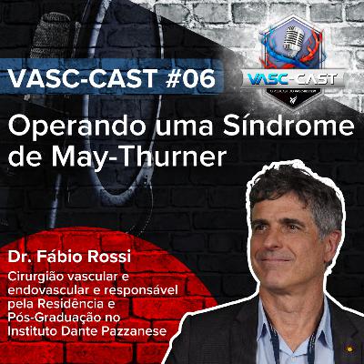 VASC-Cast #6: Operando uma Síndrome de May-Thurner com o Dr. Fábio Rossi
