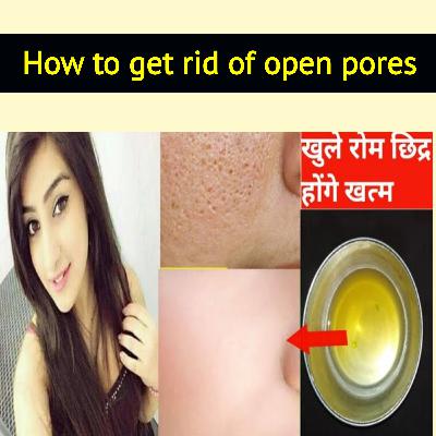 Get rid of open pores खुले रोम छिद्र खत्म करे100% result👌Clean & Clear Soft Whiten Skin