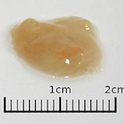 Ep.36 Phlegm in the Tea?? Twenty...... Ep.36 Phlegm in the Tea?? Twenty......