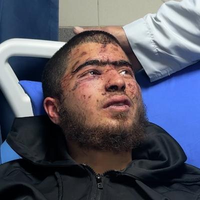 Palestinian teen says he was tortured in settler kidnapping