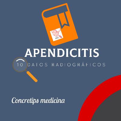 10 datos radiográficos de apendicitis aguda