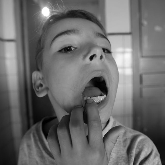 The OPTISMILE Podcast 91 - Toddler Teeth (Ages 3 to 6): The Independence Years
