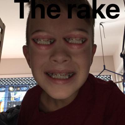 The rake