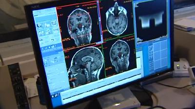 Master Class con Xurxo Mariño: ¿Cómo funciona la memoria?