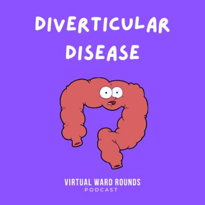 Diverticular Disease Part 1 Diverticular Disease Part 1