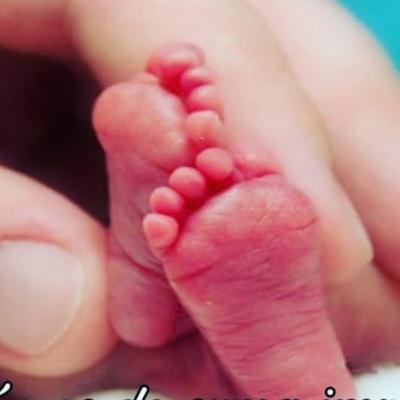 Aborto