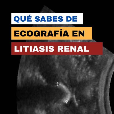 Episodio 39: Entrevista al Especialista, ¿Qué sabes de Ecografía en el Cólico Renal?
