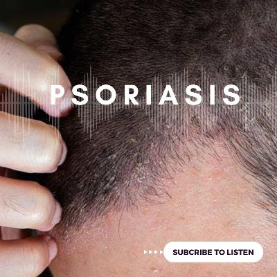 Psoriasis