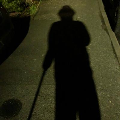 Arthritis in younger people.