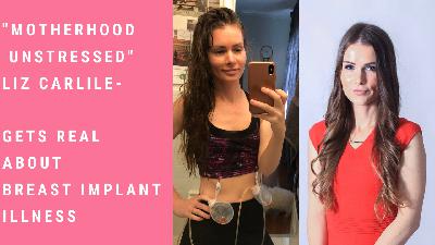Motherhood Unstressed- Liz Carlile- Gets Real About Breast Implant Illness