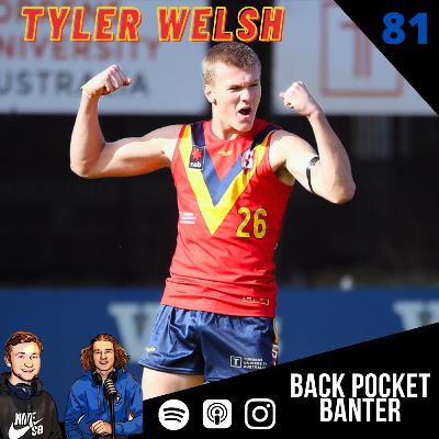 #81 - Tyler Welsh #81 - Tyler Welsh