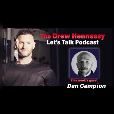 Episode 16 with Dan Campion , Alopecia , Men & Women hair loss , my hair loss !! Episode 16 with Dan Campion , Alopecia , Men & Women hair loss , my hair loss !!