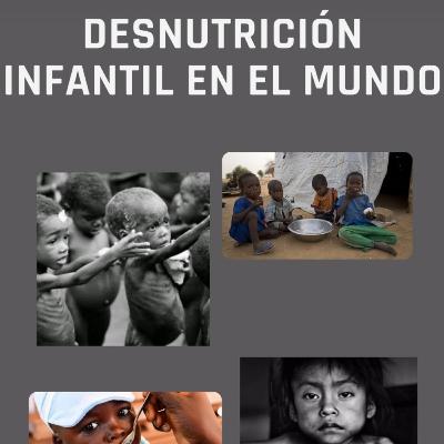 La desnutrición infantil