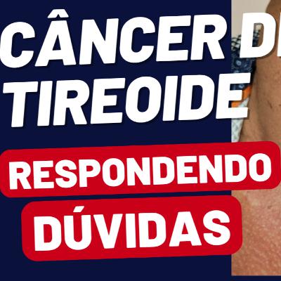 Câncer de Tireoide: Esclarecendo as Dúvidas Mais Comuns Câncer de Tireoide: Esclarecendo as Dúvidas Mais Comuns