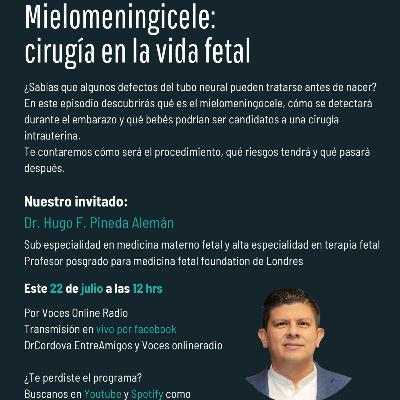Mielomeningicele: Cirugía en la Vida Fetal Mielomeningicele: Cirugía en la Vida Fetal