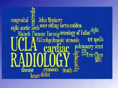 Tetralogy of Fallot - Standard Definition