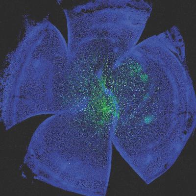 Ep.3 – Cornea-copia