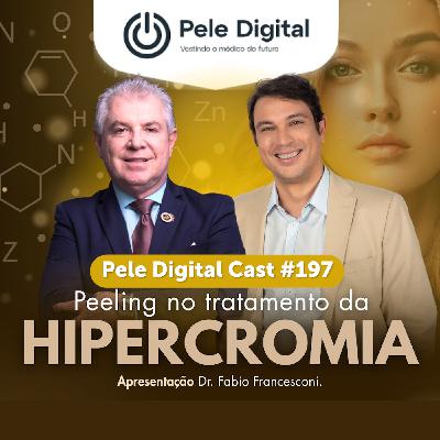 Pele Digital Cast #197 - Peeling no tratamento da hipercromia Pele Digital Cast #197 - Peeling no tratamento da hipercromia