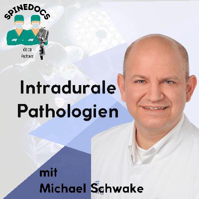 Intradurale Pathologien Intradurale Pathologien