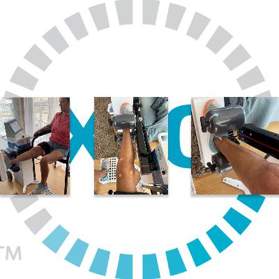 Knee Replacement Recovery for Women: Your Guide to Strength & Renewed Mobility