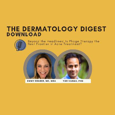 Beyond the Headlines: Is Phage Therapy the Next Frontier in Acne Treatment?